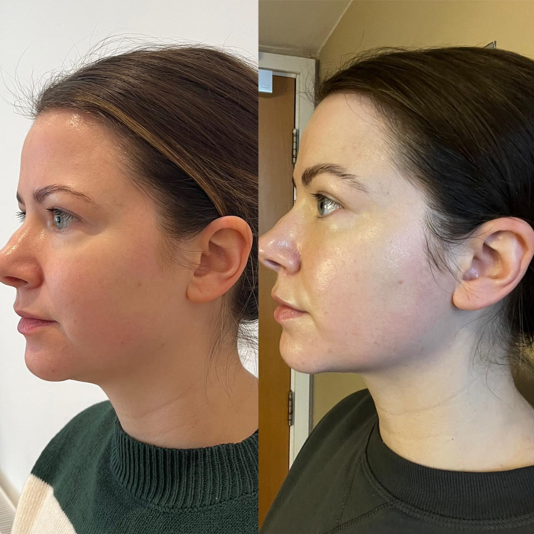 Lymphatic Drainage Wellness Drops