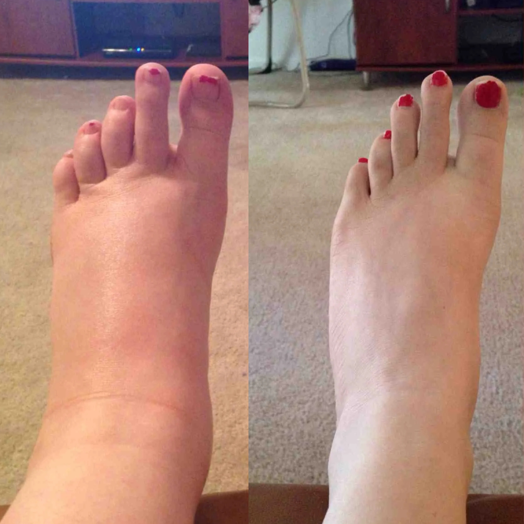 Lymphatic Drainage Wellness Drops