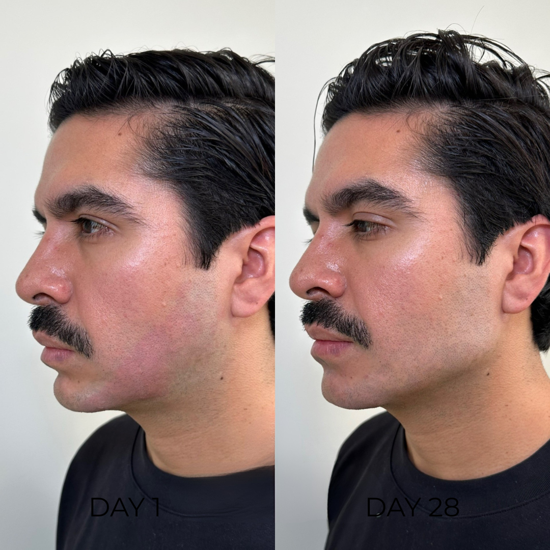 Lymphatic Drainage Wellness Drops