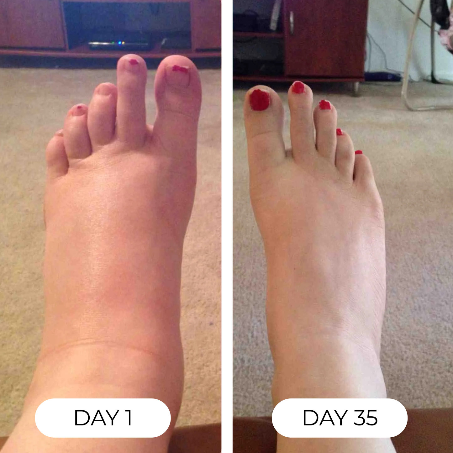 Nature's Roots Lymphatic Support Drops — Naturally Reduces Swelling, Puffiness, Bloating, and Heavy legs