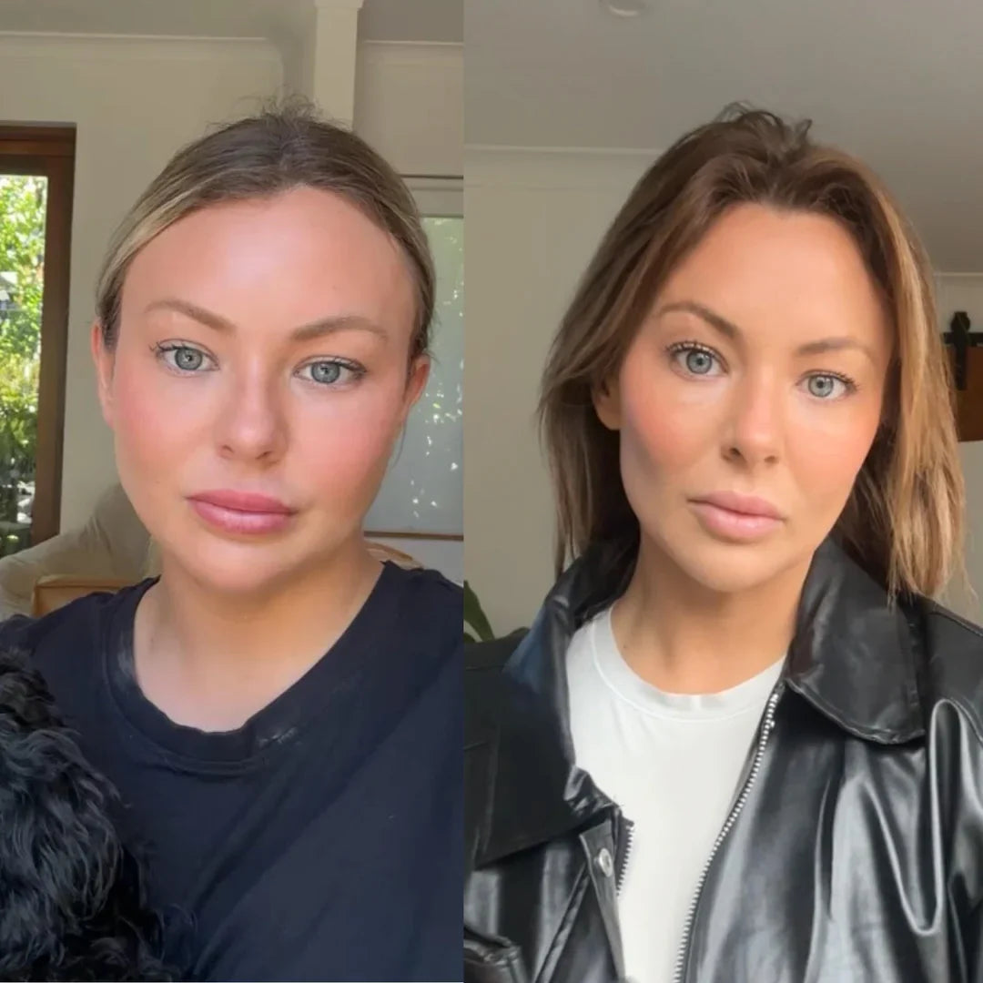 Woman with facial swelling that changes throughout the day
