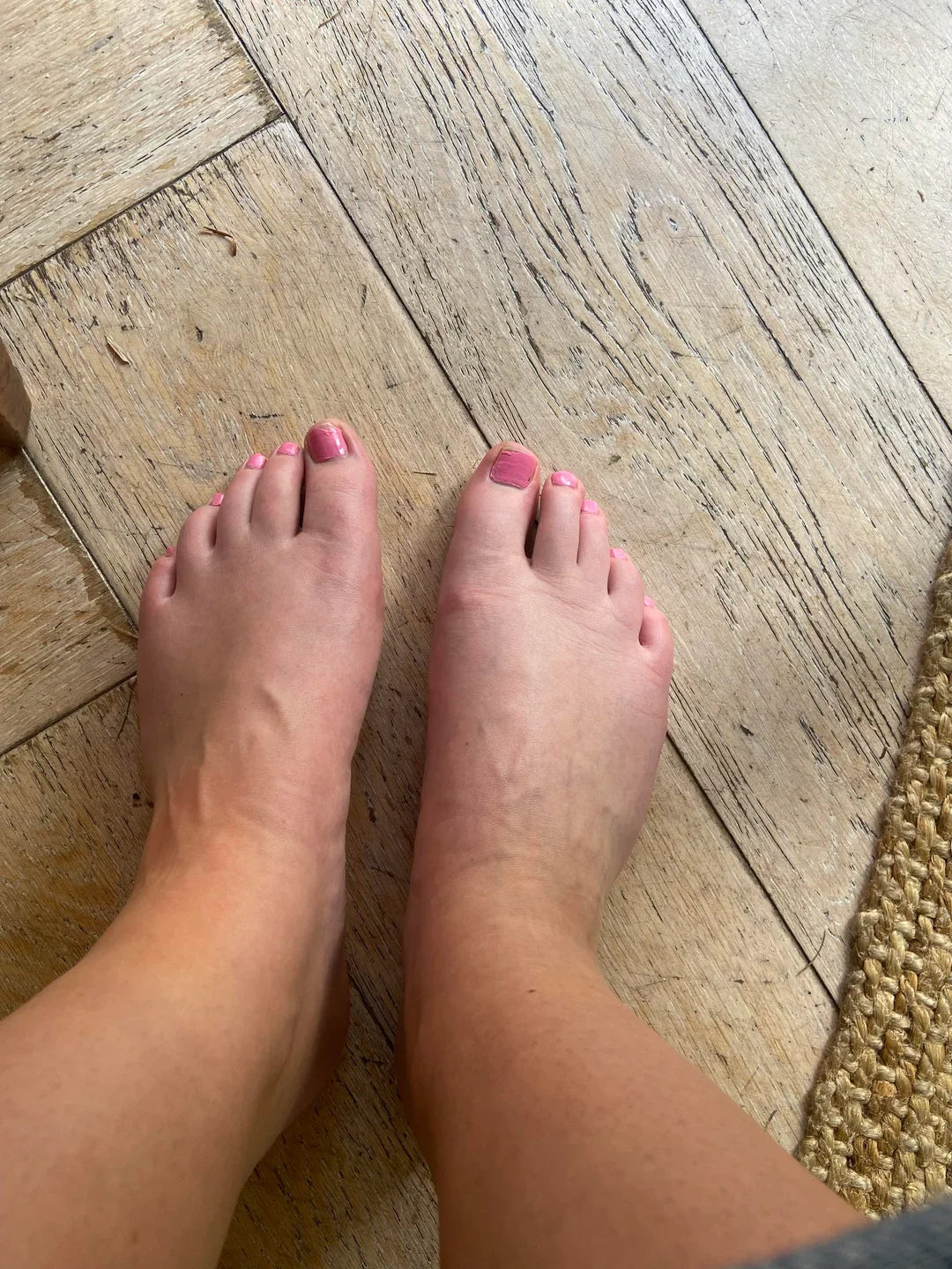 Swollen puffy feet after sitting too long